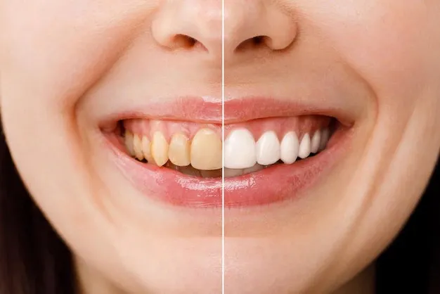 Cosmetic dentistry smile enhancement before and after treatment